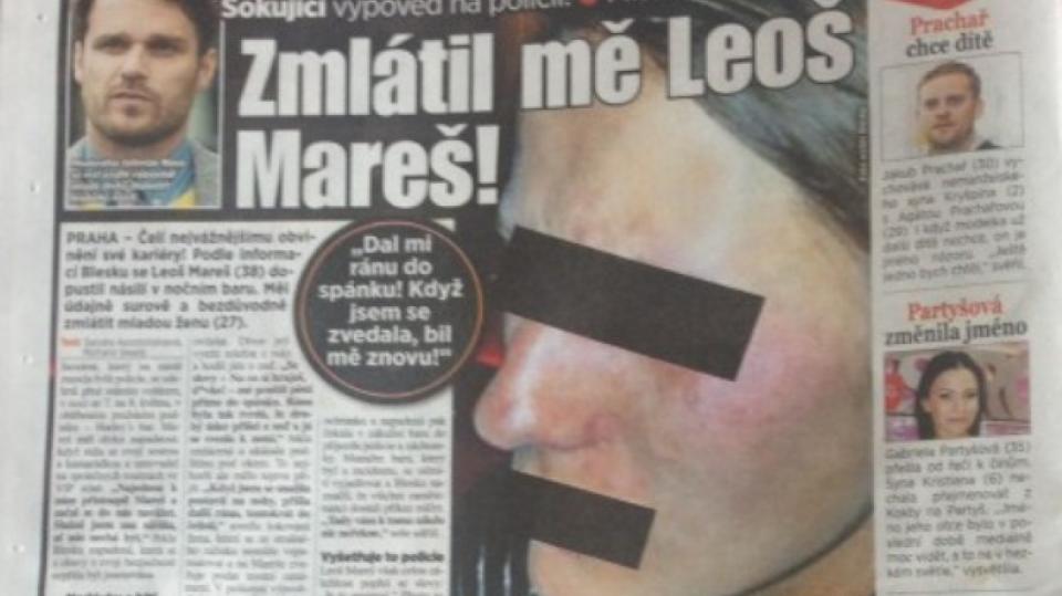 Dívka údajně zmlácená Leošem Marešem...